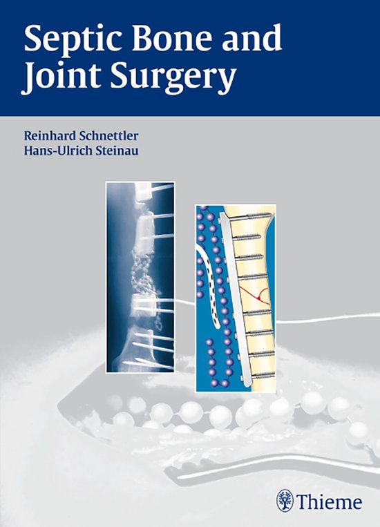 Septic Bone and Joint Surgery - cover