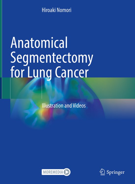 Anatomical Segmentectomy for Lung Cancer - cover