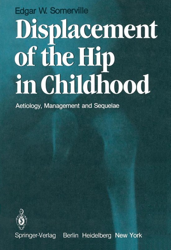 Medicine (R0) - Displacement of the Hip in Childhood - cover