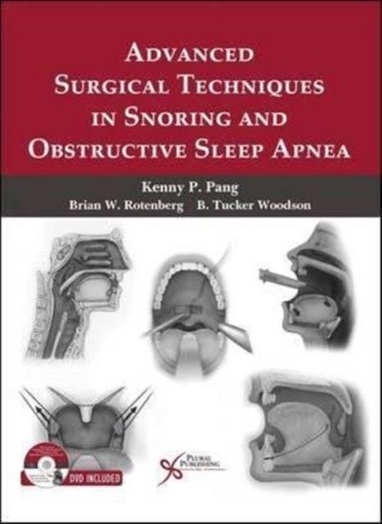 Advanced Surgical Techniques in Snoring and Obstructive Sleep Apnea