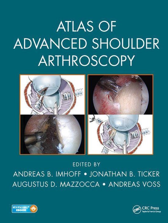 Atlas of Advanced Shoulder Arthroscopy - cover