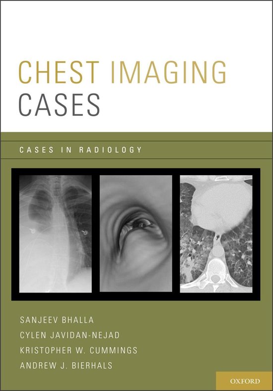 Cases in Radiology Chest Imaging Cases (ebook), Sanjeev Bhalla