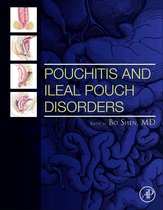 Pouchitis and Ileal Pouch Disorders