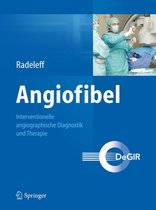 Angiofibel