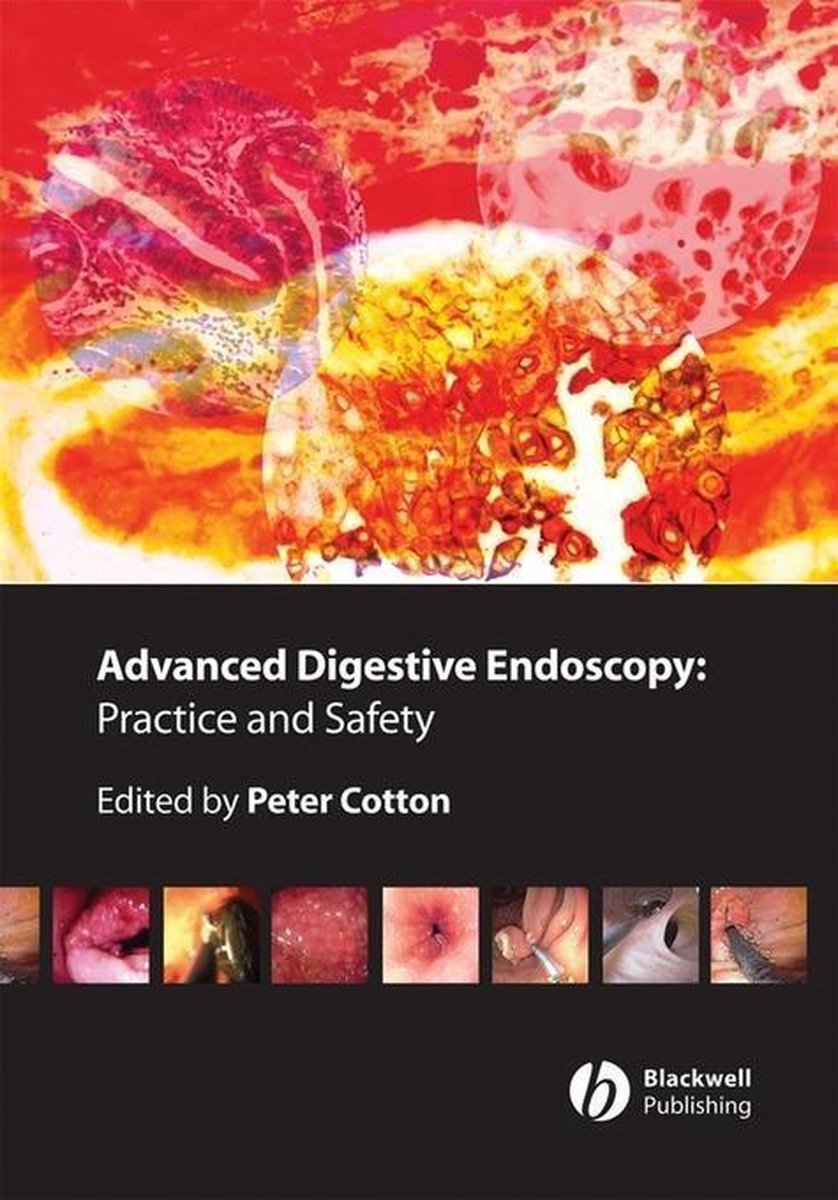 Advanced Digestive Endoscopy Practice and Safety (ebook), Ian D. Hay 9781444300277...