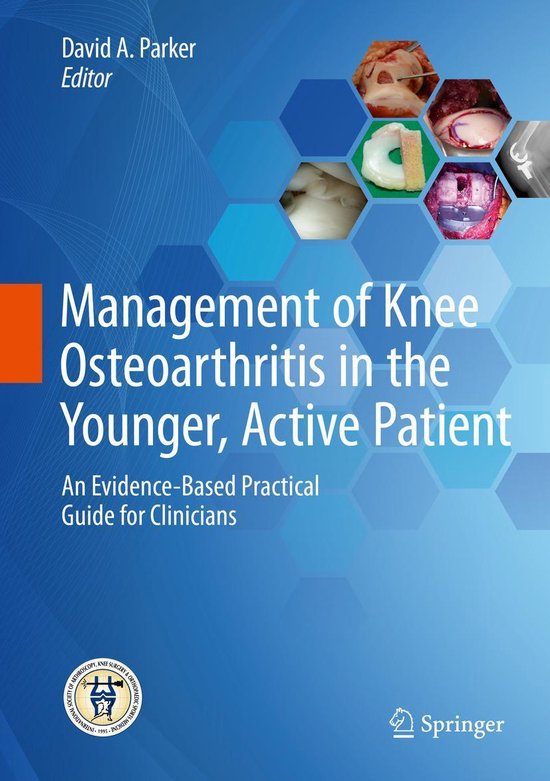 Medicine (R0) - Management of Knee Osteoarthritis in the You ... - cover