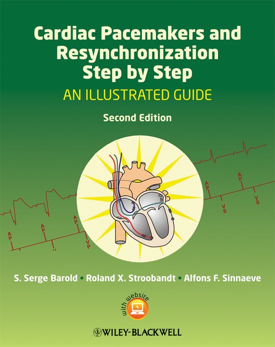 ISBN Cardiac Pacemakers and Resynchronization Step by Step: An Illustrated Guide, Santé, esprit et corps, Anglais, 480 pages