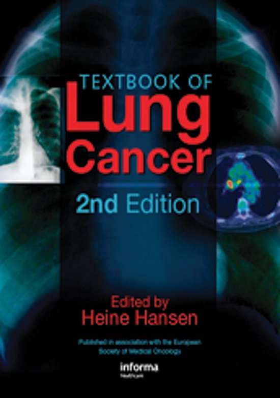 Textbook of Lung Cancer - cover