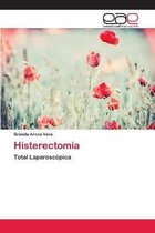 Histerectomía