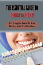 The Essential Guide To Dental Implants: Keys Everyone Needs To Know About A Smile Transformation