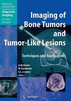 Imaging of Bone Tumors and Tumor Like Lesions