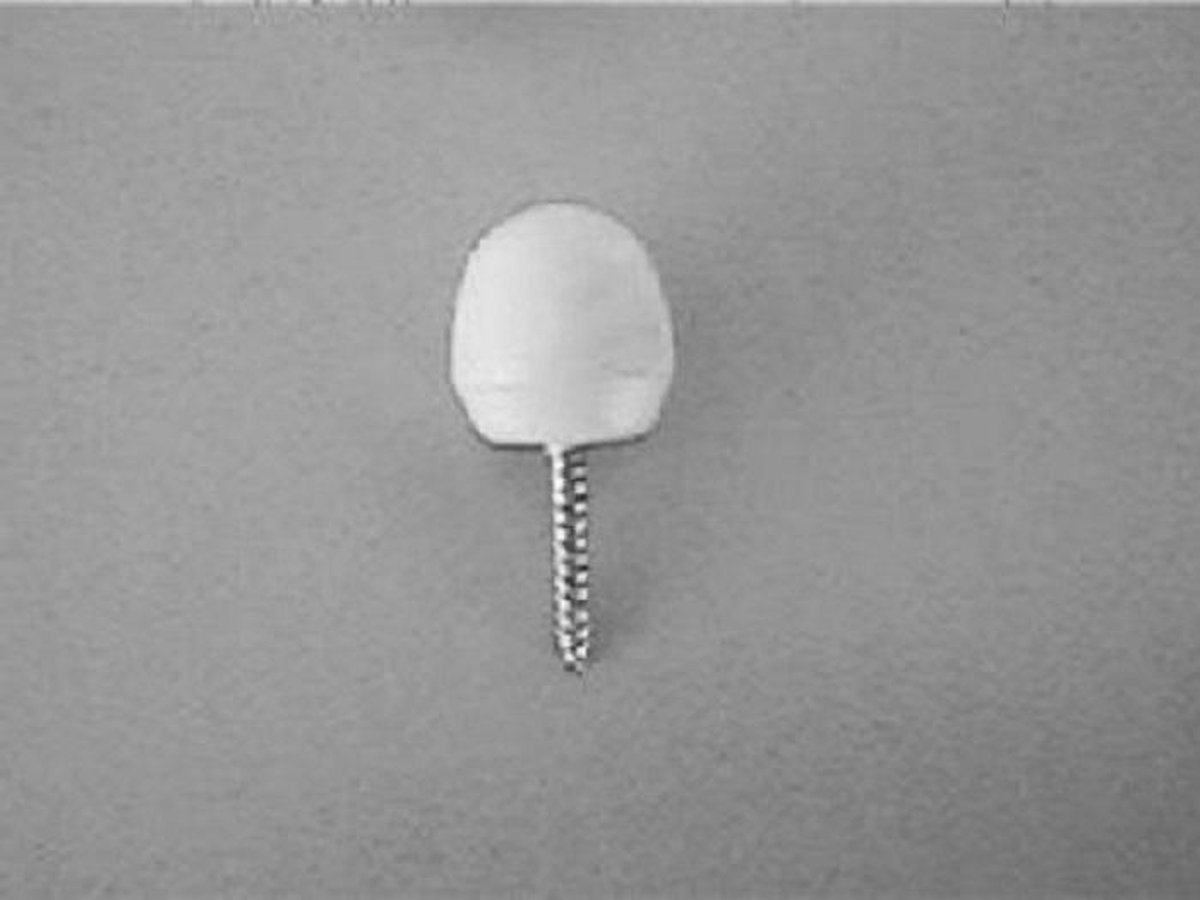 Haken +knoppen voor spiraal 4 stuks - Anchor