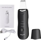 Skin Blackhead Remover - Puisten Verwijderaar