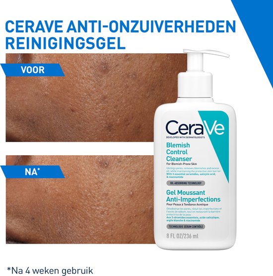 CeraVe Blemish Control Cleanser voor onzuivere huid. Fles met pompdispenser. Voor en na 4 weken gebruik.