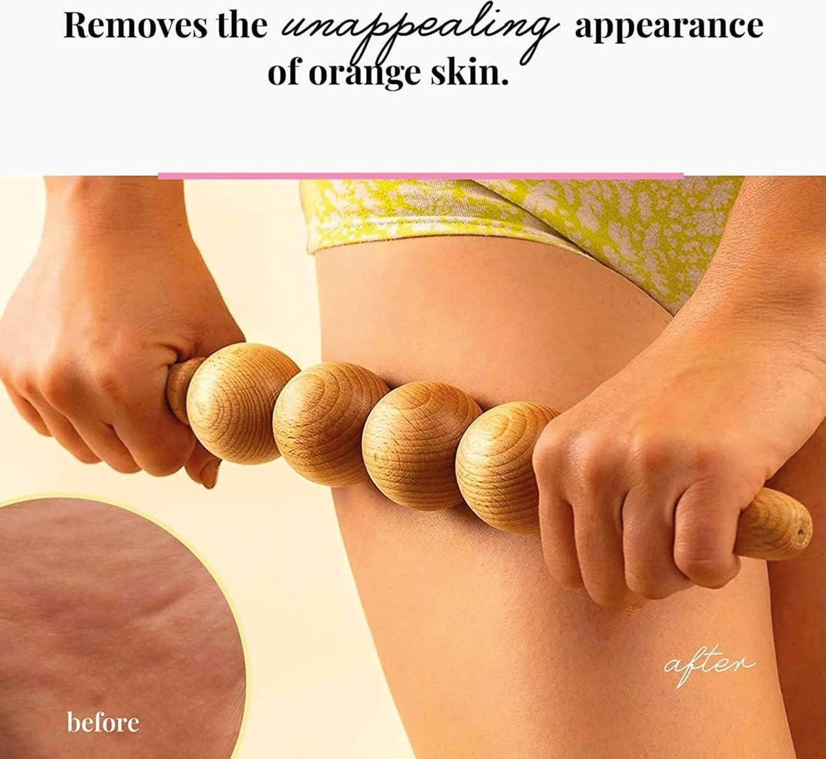 Anti-cellulitis bal massageapparaat - effectieve massageroller voor buik, benen en dijen - lymfedrainage maderotherapie van hout
