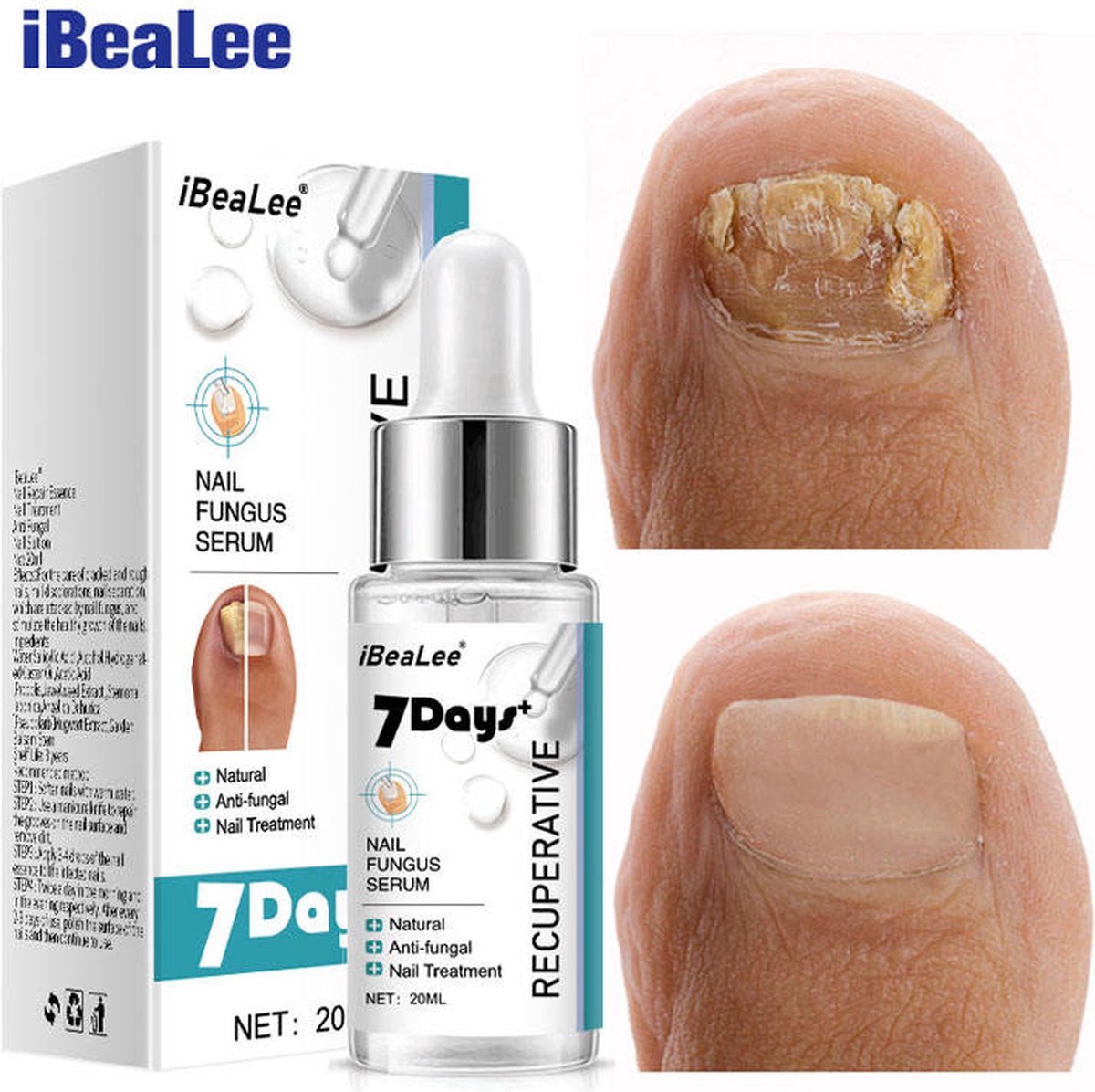 Goedkoopste Nagelverzorging 30ml | Voor verkleurde, gescheurde, ruwe nagels, schimmelnagels & kalknagels |