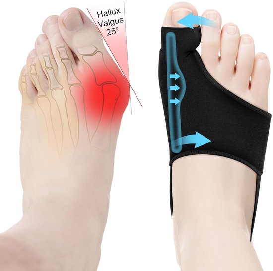 Hoge Kwaliteit Hallux Valgus Sok Grote Teencorrector Per Paar