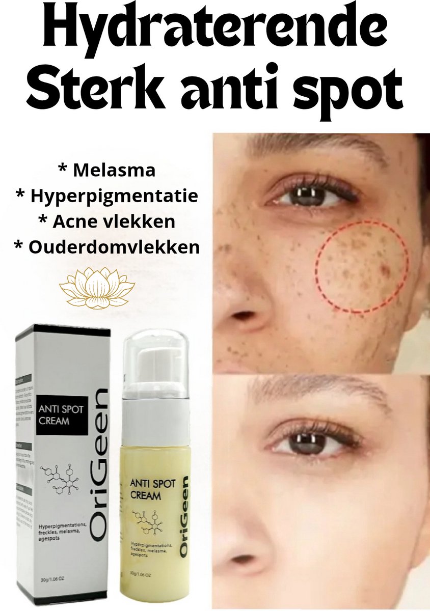 Goedkoopste Origeen sterk Hydraterende anti pigmentvlekken dag/nacht creme - Hyperpigmentation - freckles - melasma - Agespots - Organic - Hydraterend - Donkere vlekken verhelderen - Geschikt voor gevoelige huid