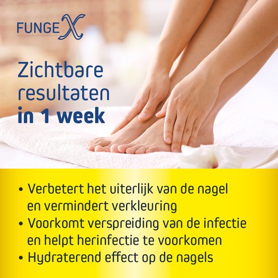 FungeX Kalknagel Pleister - Voetschimmel Behandeling - Alternatief Voetschimmel Creme - Zwemmerseczeem Behandeling - Schimmelnagel - Kalknagelbehandeling