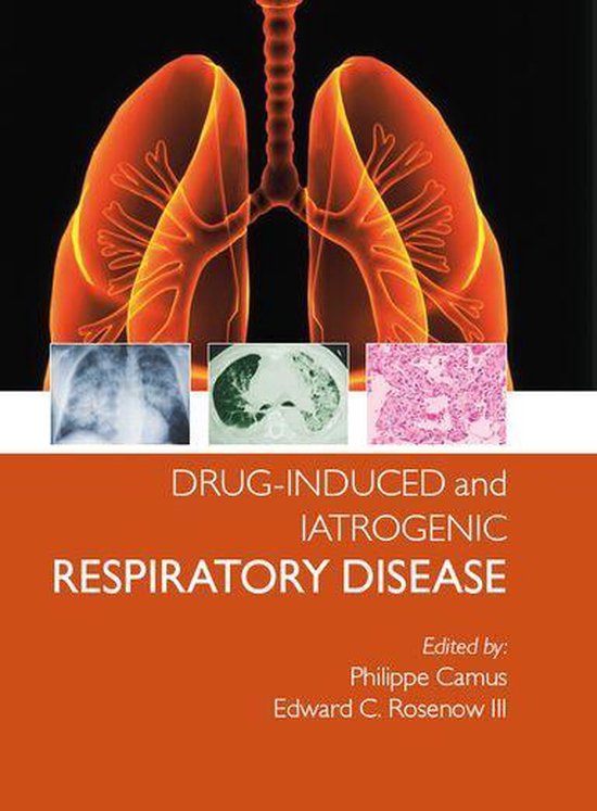 Drug-induced and Iatrogenic Respiratory Disease - cover