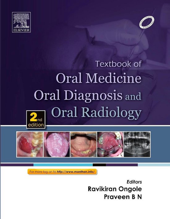 Textbook of Oral Medicine, Oral Diagnosis and Oral Radiology - E-Book ...