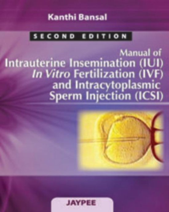 Manual Of Intrauterine Insemination Iui In Vitro Fertilization Ivf And 8378