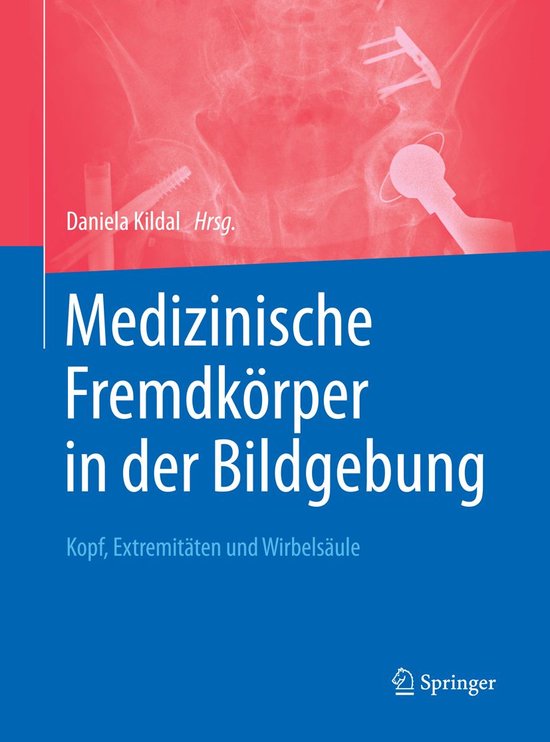 Medicine (German Language) - Medizinische Fremdkörper in de ... - cover