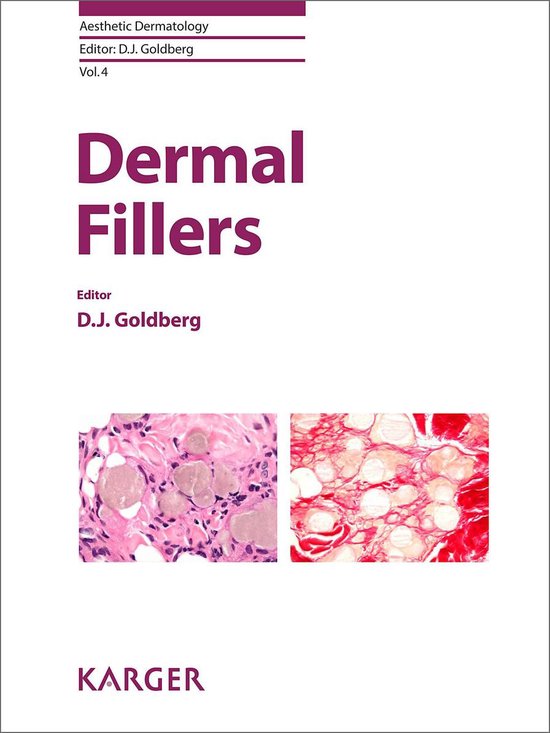 Dermal Fillers - cover