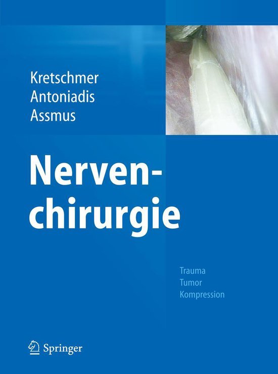 Nervenchirurgie - cover