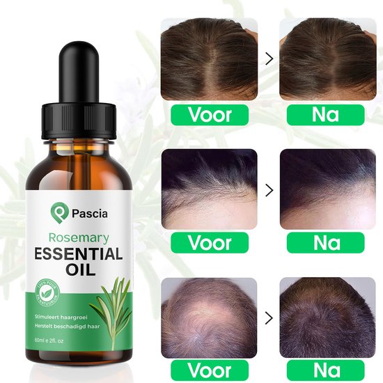 Flesje rozemarijnolie naast voor-en-na foto's van hoofdhuid en haar. Tekst: 'Voor' en 'Na'.