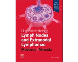 Diagnostic Pathology: Lymph Nodes and Extranodal Lymphomas
