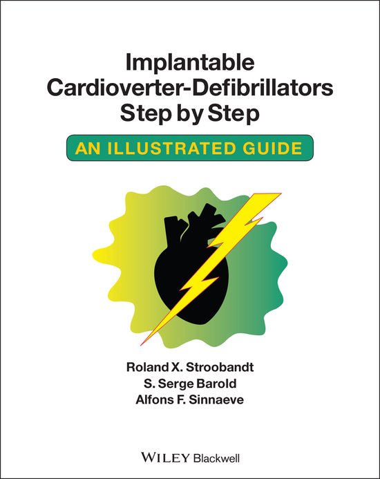 Foto: Implantable cardioverter defibrillators step by step