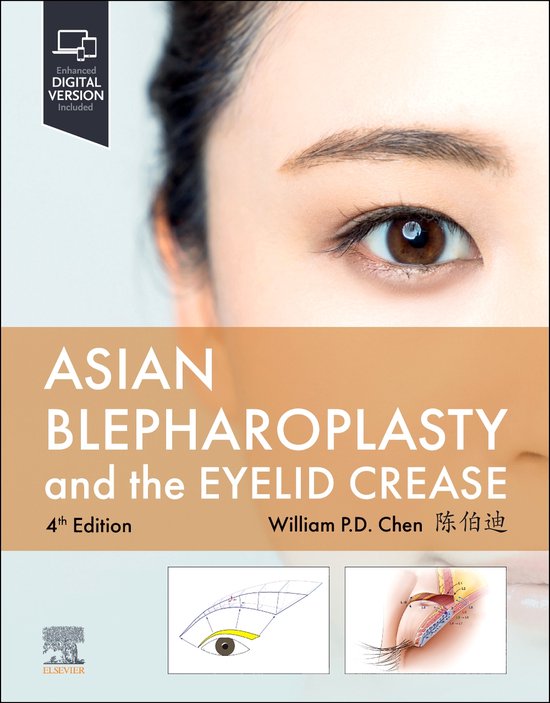 Asian Blepharoplasty and the Eyelid Crease - cover