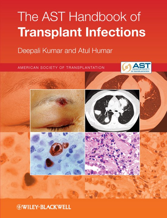 Ast Handbook Of Transplant Infections - cover