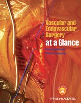 Vascular & Endovascular Surgery At A Gla