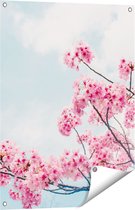 Gards Tuinposter Roze Bloesemboom - Bloemen - 60x80 cm - Tuindoek - Tuindecoratie - Wanddecoratie buiten - Tuinschilderij