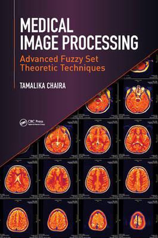 Medical Image Processing 9781498700450 Tamalika Chaira Boeken