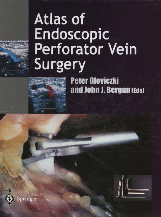 Atlas of Endoscopic Perforator Vein Surgery - cover