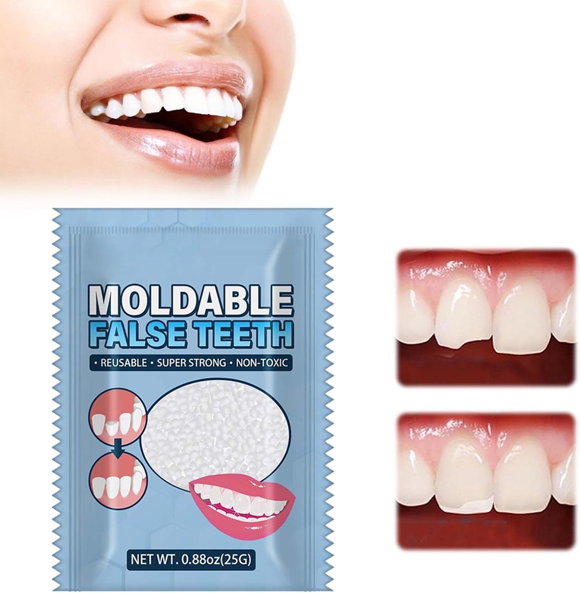 Temporary Tooth Repair,Temporary Moldable False Teeth,Temporary Tooth Filling,Teeth Repair Kit,for Halloween Theme - ShopVlot