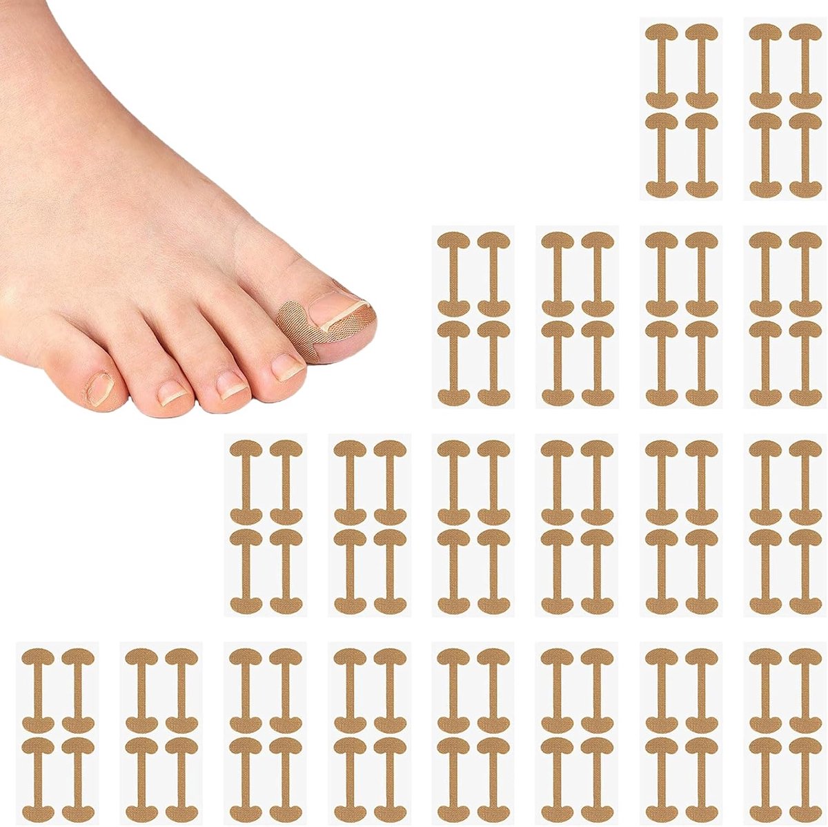 Teennagelpleisters 80 stuks - ingegroeide teennagels - pijnverlichting - langdurige correctie - ShopVlot