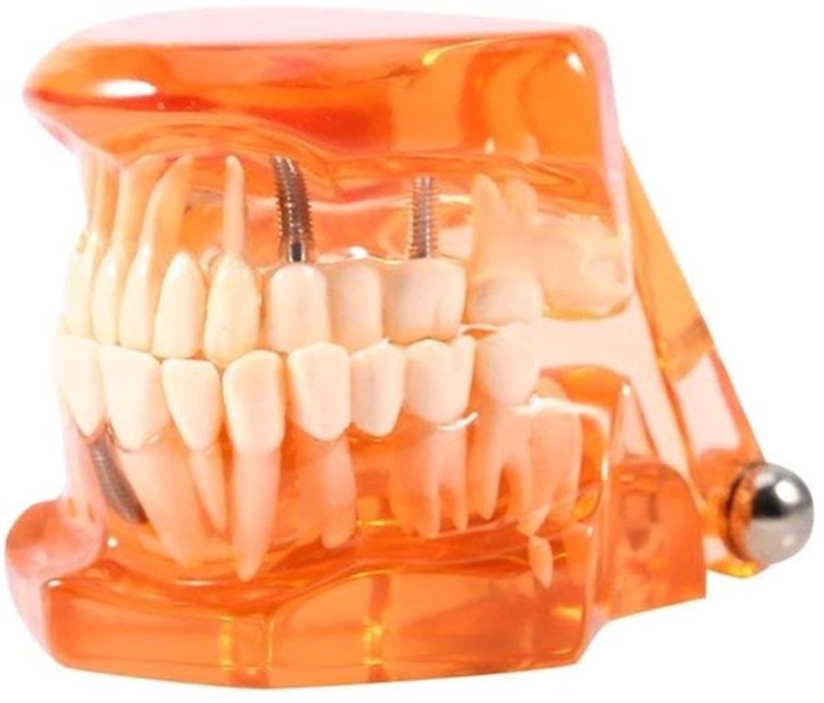 Tandarts model - Tandheelkundige demonstratie - Oranje kleur - Implantatie en protheses - Onderwijs en presentaties - Geschikt voor tand
