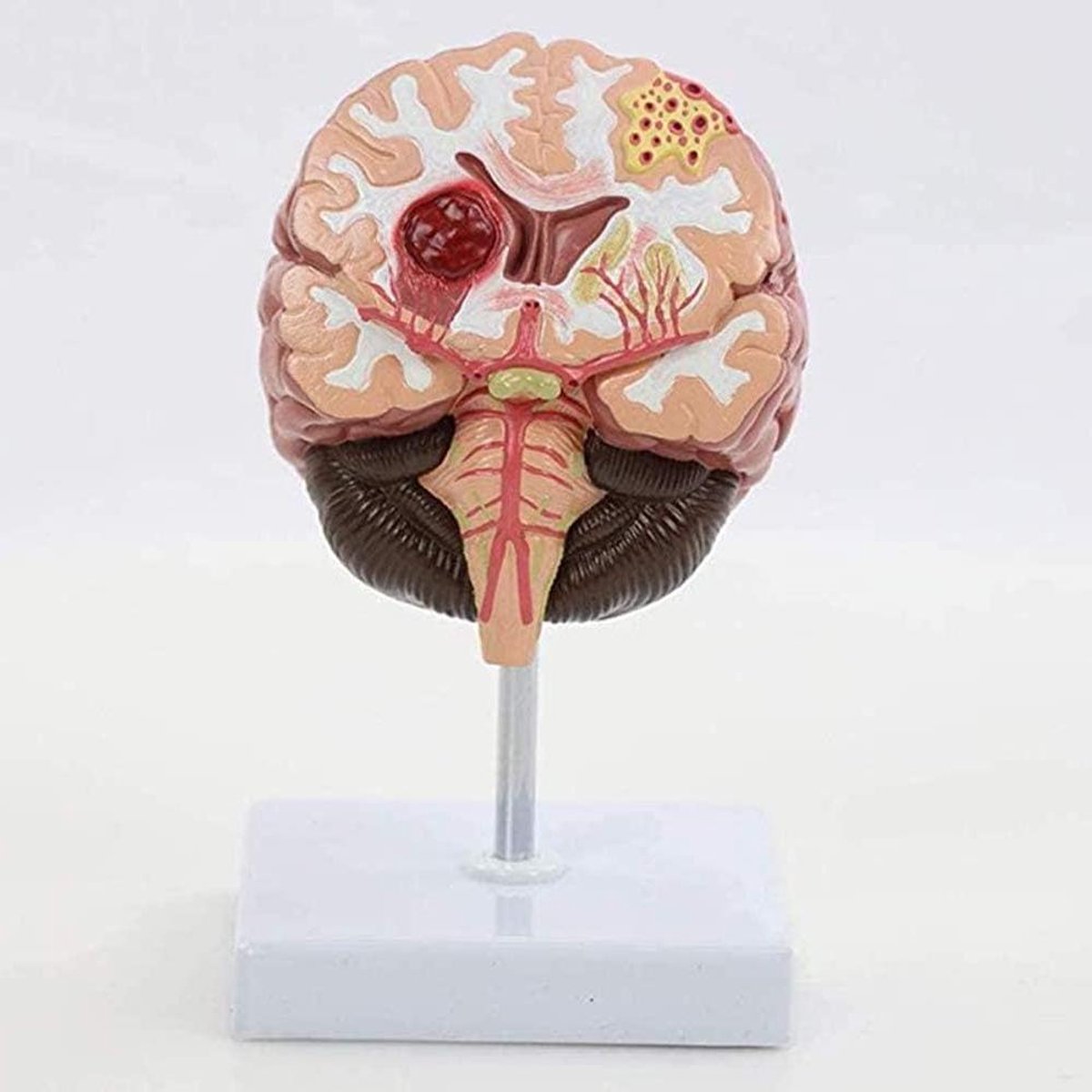 Menselijk Lichaamsmodel Brein - Anatomisch Model Hersenen - Onderwijs Medisch - Cardiovasculair Cerebrovasculair - Niet gespecificeerd - Gekleurd