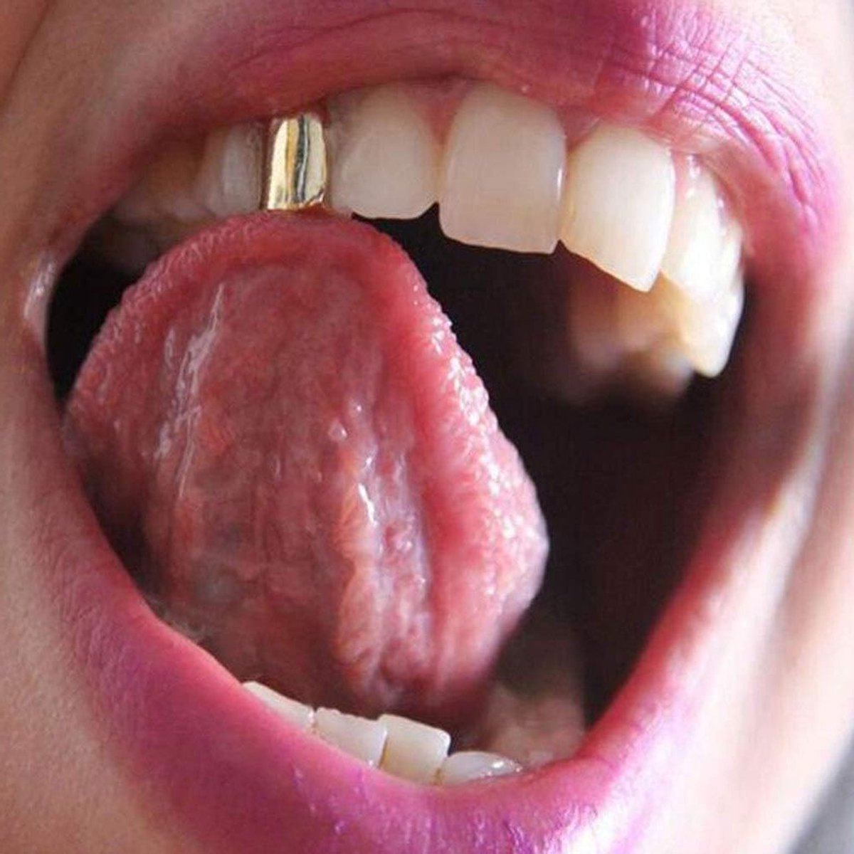 Single Tooth Hip Hop Cap voor Halloween Feest - Cosplay Accessoires voor Kostuums, Carnaval en Party Favors - 2 Stuks