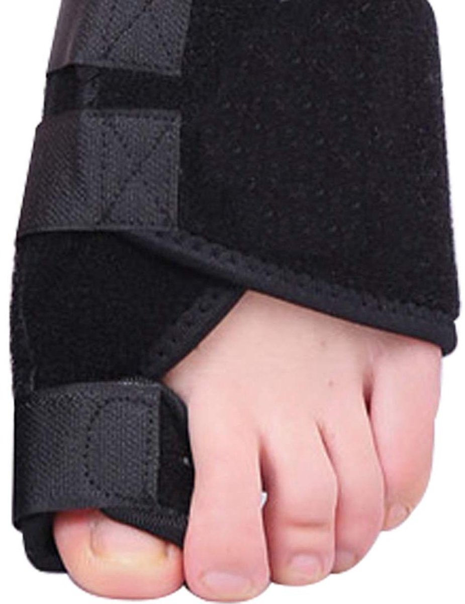 Teen corrector spalk - Hallux valgus brace - Pijnverlichting eeltknobbel - Verstelbare aluminium brace - 3 paar - Wit