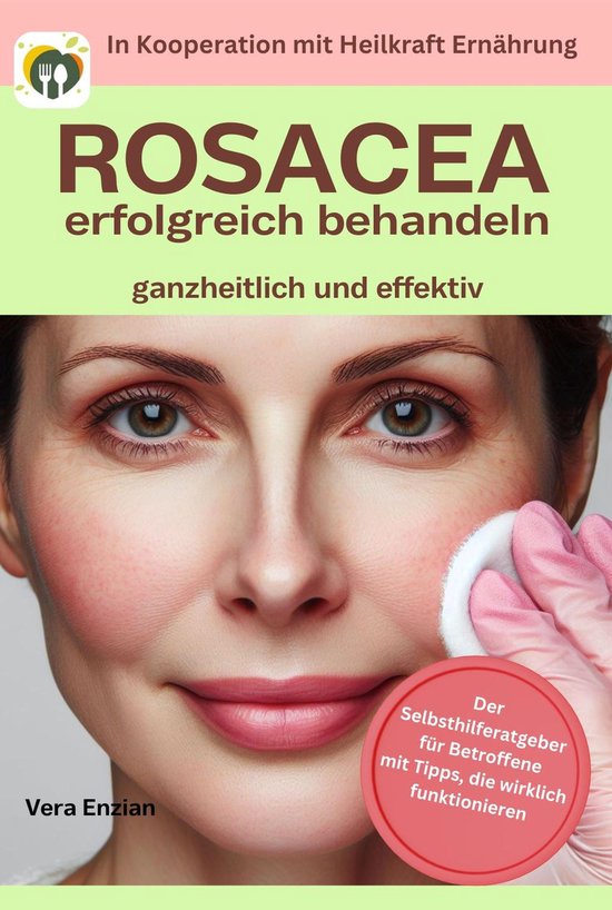 Rosacea erfolgreich behandeln - ganzheitlich und effektiv - cover