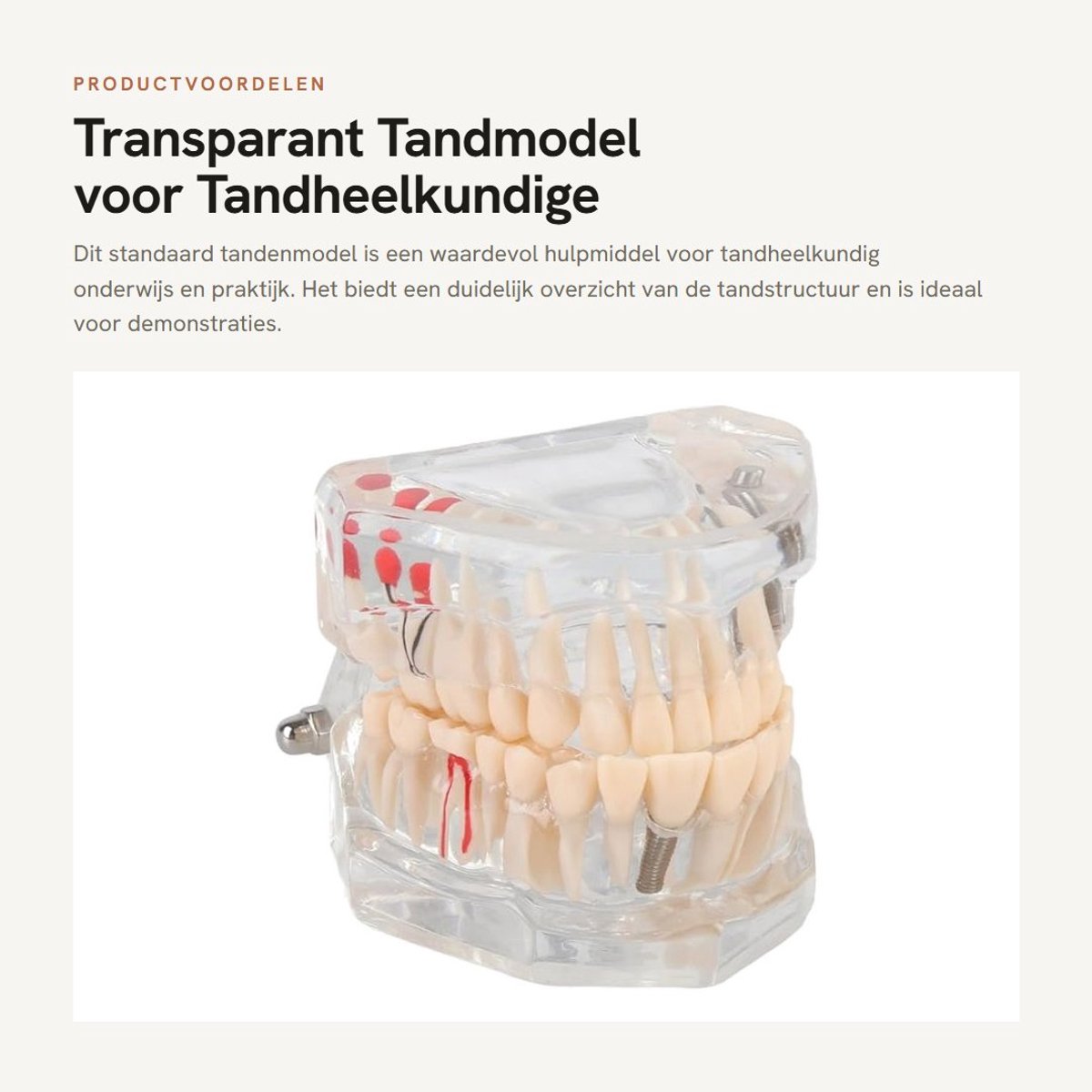 Dailygoods- Tandmodel Volwassen - Transparant Demonstratie Model - Tandheelkundig Model - Oraal Pathologisch Model - 9x7x7cm - Kunststof 232g