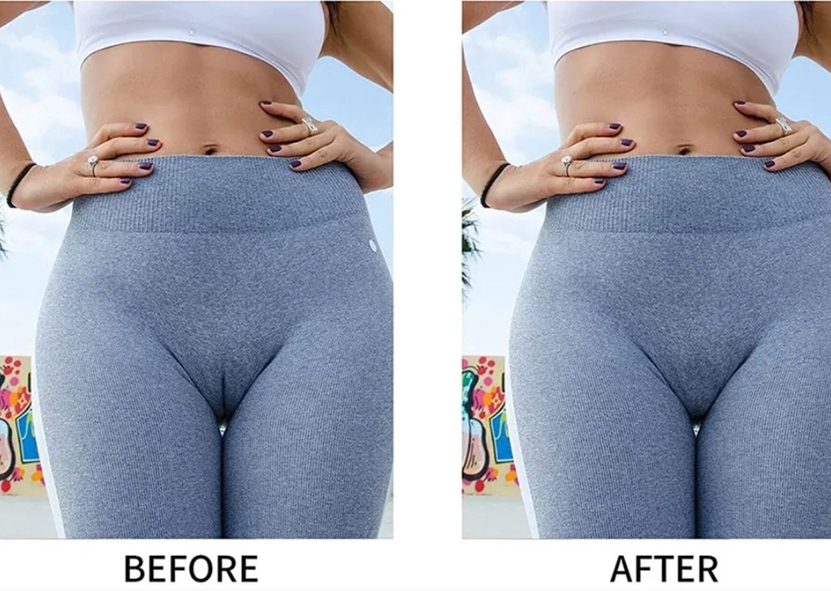 Ilso anti camel toe pads - kameel teen concealer - legging - sport kleding  - badmode -... | bol