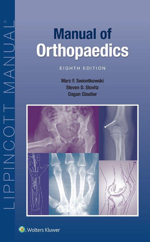 Lippincott Manual Series - Manual of Orthopaedics - cover