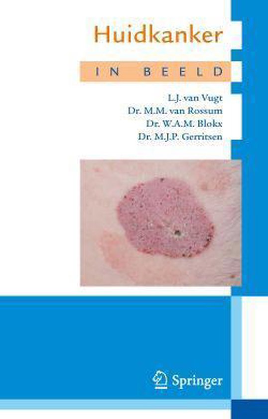 Cover van het boek 'Huidkanker in beeld'