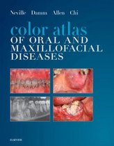 Color Atlas of Oral and Maxillofacial Diseases - E-Book